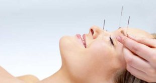 Aculifting, il lifting senza chirurgia: ti va di provare?