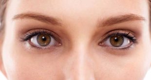 Le rughe verticali sotto gli occhi rovinano il mio sguardo