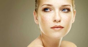 Le tecniche per eliminare le macchie di pigmentazione