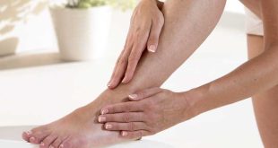 Macchie bianche sulle gambe: cosa faccio?