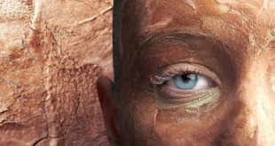 Peeling: quando la pelle ha bisogno di lanciarsi all'avventura?