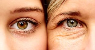 Quanti anni ha veramente la tua pelle