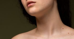 Tutto quello che devi sapere sui nei