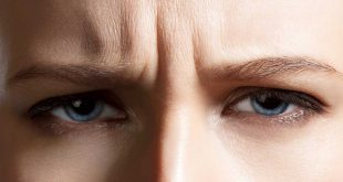 Viso stanco? Tutta colpa delle rughe verticali!